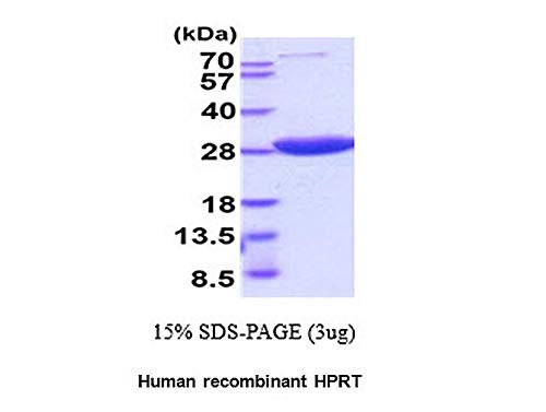 P1092-10-Veličina : 10 mikrograma - HPRT1, humani rekombinantni, BioVision Inc - svaki