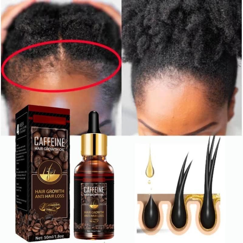 Đumbir Hair Growth Essence ulje Alopecia Hair Treatment za žene hranljiva njega za kosu hranljivi rastvor