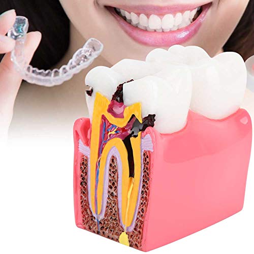 Model zuba, kompaktna odlična anatomija zuba model izdržljive smole za zubnu laboratoriju za oralnu njegu